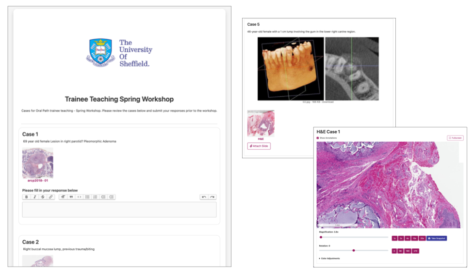Screenshots of Pathogenesis showing a sample quiz, a digital pathology slide and some case photographs